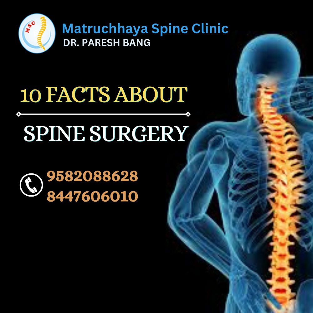 10 facts about Spine Surgery