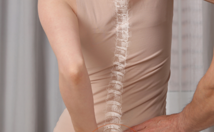 Scoliosis and Its Surgical Correction